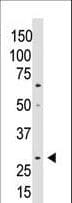 Polyclonal Rabbit anti-Human CCN5 Antibody (aa87-116, IHC, WB)