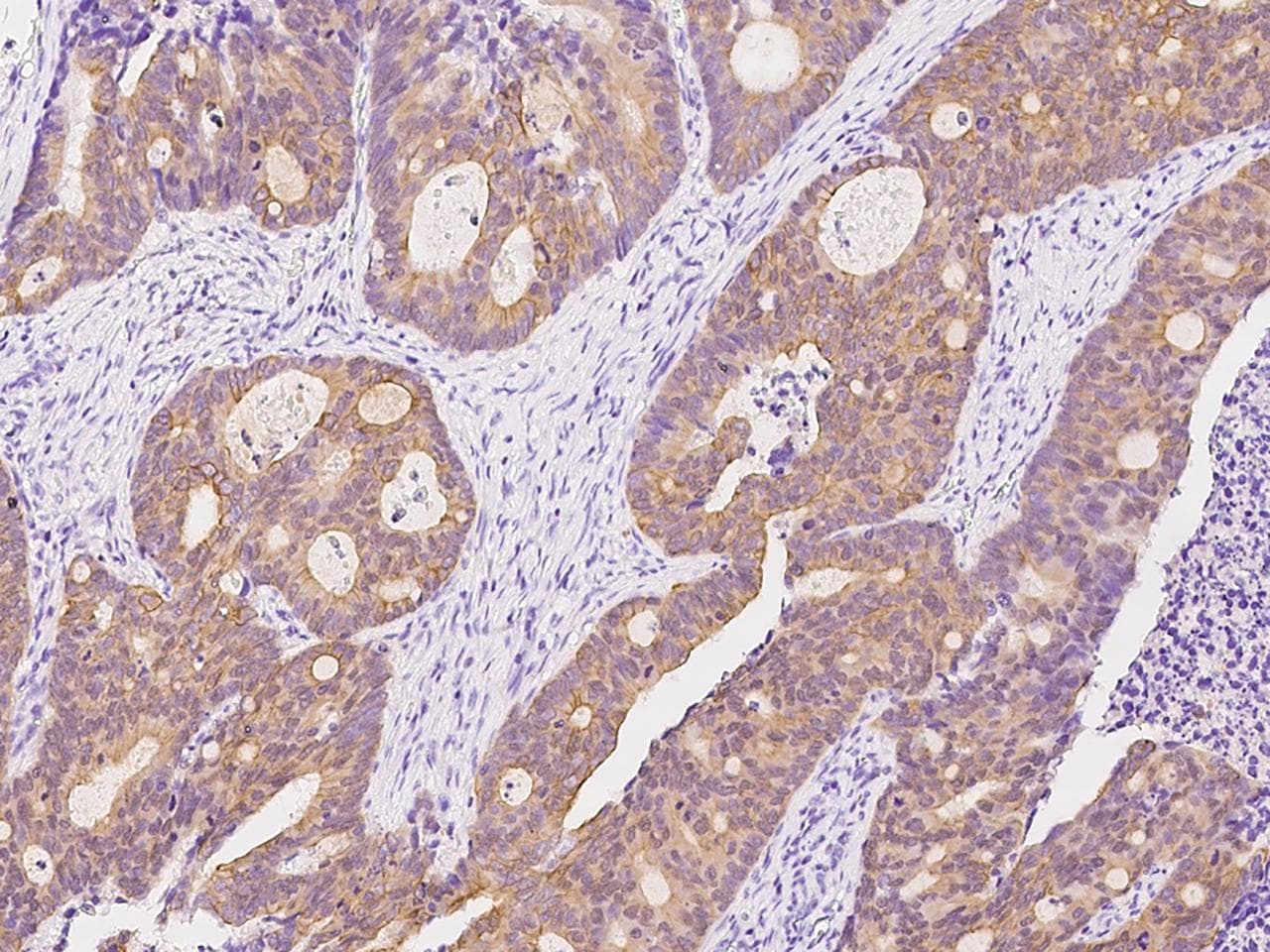 CDK2 Antibody (Preservative Free)