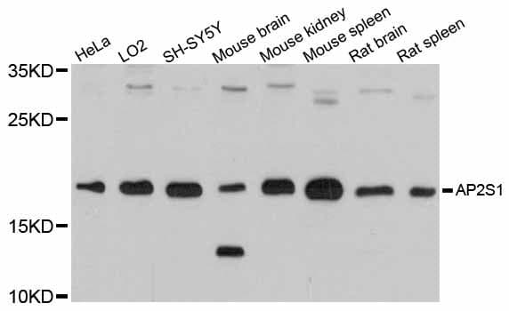 Polyclonal Rabbit anti-Human AP2S1 Antibody (WB)