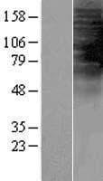 TAS2R1 Protein (Over-Expression Lysate Myc-DDK (Flag))