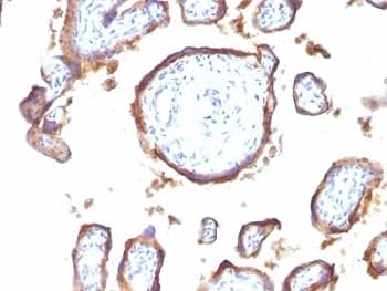 EGFR Antibody (clone GFR1195)