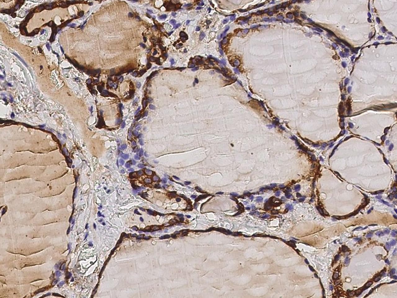 Monoclonal Mouse anti-Human TPO / Thyroid Peroxidase Antibody (clone 23, Preservative Free, IHC)