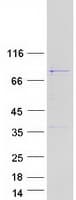 Human MAGED2 Protein (Recombinant Myc-DDK (Flag))