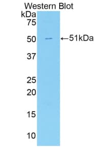 CDH13 / Cadherin 13 Antibody (aa478-690)