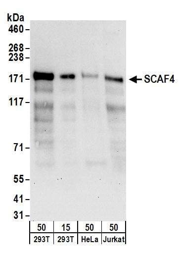 Polyclonal Rabbit anti-Human RBM33 Antibody (aa1-50, WB)