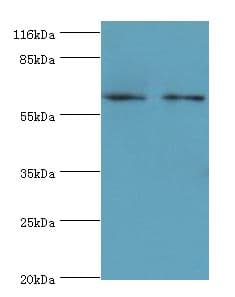 Polyclonal Rabbit anti-Human GALNT14 Antibody (Biotin, aa1-552, IHC, WB)