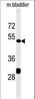 Polyclonal Rabbit anti-Human KLC3 Antibody (aa245-274, IHC, WB)