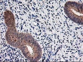 ALS2CR1 / NIF3L1 Antibody (clone OTI2B7)