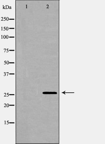 LGALS3 / Galectin 3 Antibody