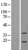 ASF1A Protein (Over-Expression Lysate Myc-DDK (Flag))