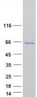 Human NUP50 Protein (Recombinant Myc-DDK (Flag))