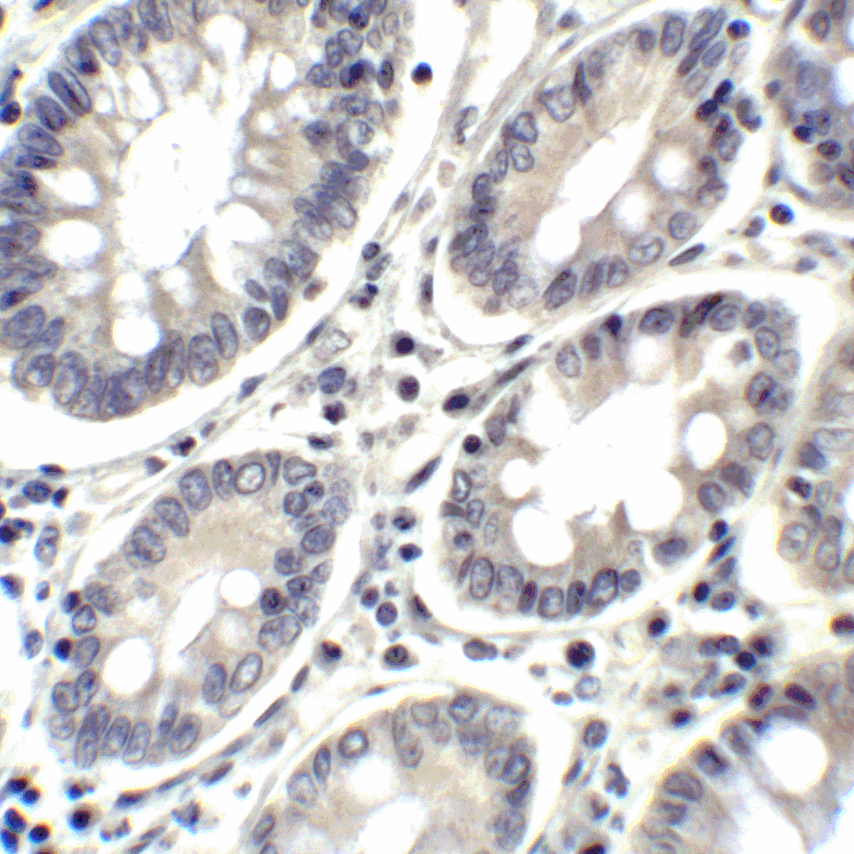 PD-L2 / PDCD1LG2 / CD273 Antibody (clone 7C1)