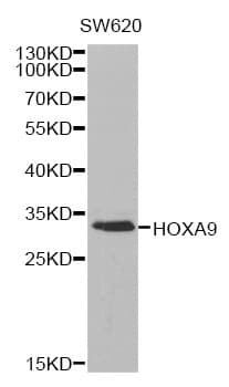 Polyclonal Rabbit anti-Human HOXA9 Antibody (IHC, WB)