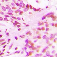 Polyclonal Rabbit anti-Human Histone H3 Antibody (Acetyl-Lys27, IHC, IF, WB)