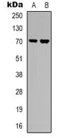 Polyclonal Rabbit anti-Human RPS6KB1 / P70S6K / S6K Antibody (Internal, IHC, IF, WB)