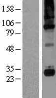C1QG / Complement C1QC Protein (Over-Expression Lysate Myc-DDK (Flag))
