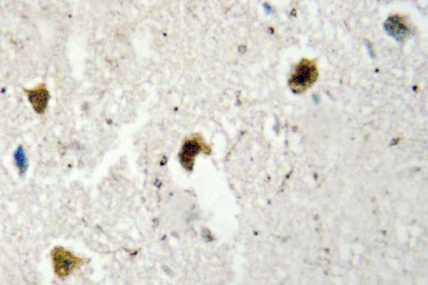 HNRNPH1 / hnRNP H Antibody (Arg192)