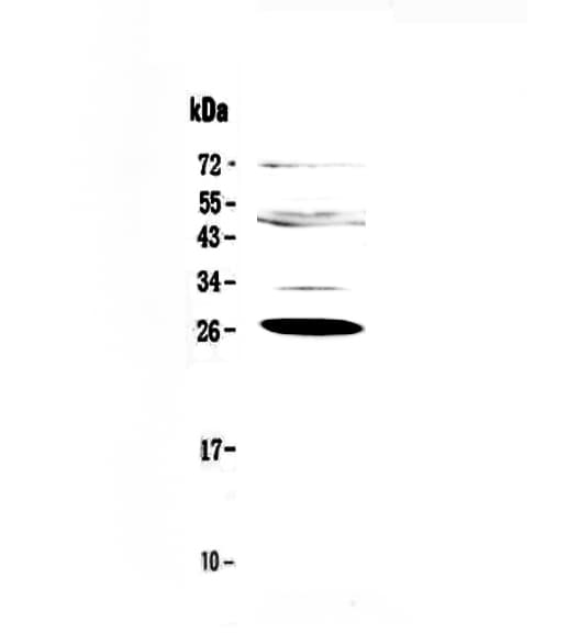 CFD / Factor D / Adipsin Antibody