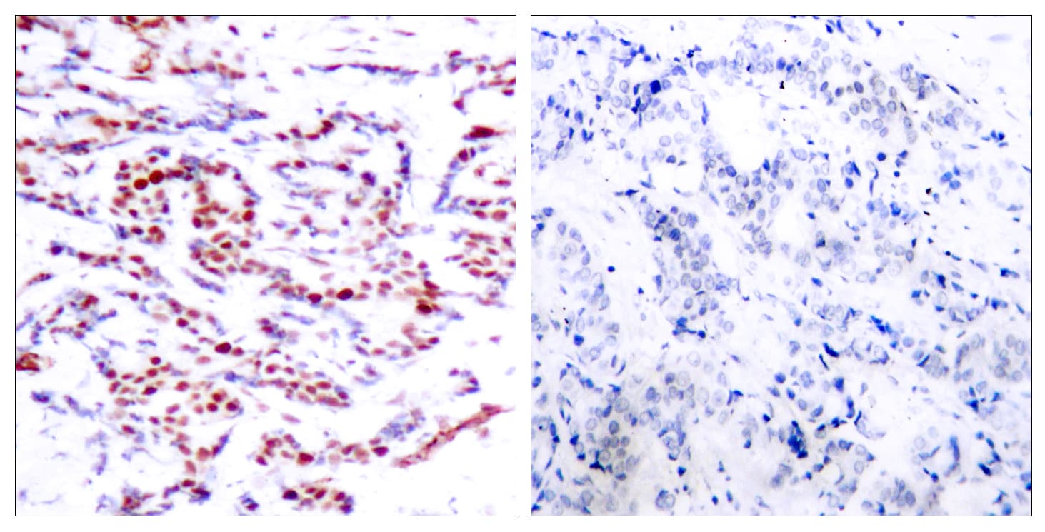 ATF2 Antibody (phospho-Thr71/Thr53)