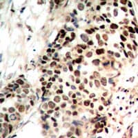 HDAC3 Antibody (phospho-Ser424)
