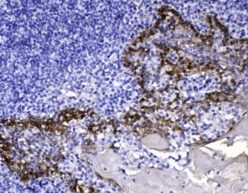 KRT14 / CK14 / Cytokeratin 14 Antibody