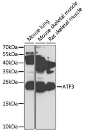Polyclonal Rabbit anti-Human ATF3 Antibody (WB)