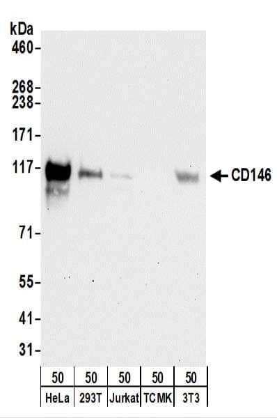 MCAM / CD146 Antibody (aa600-650)