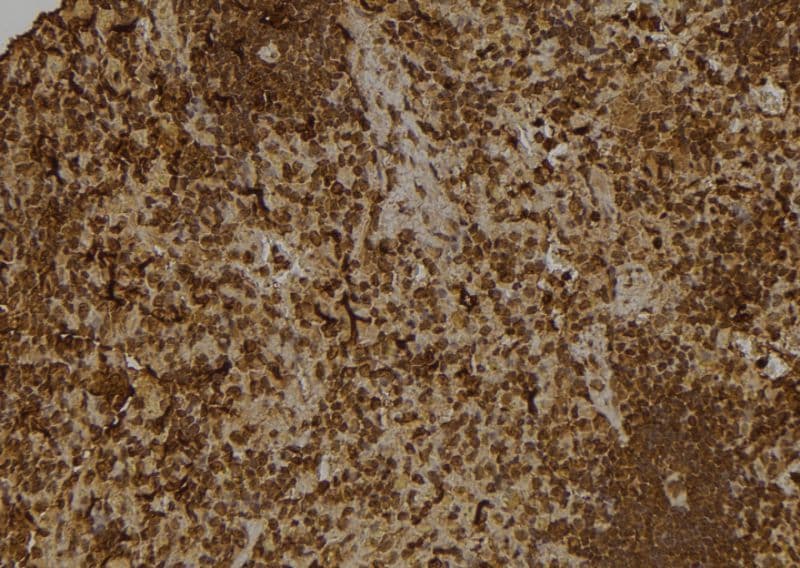 Polyclonal Rabbit anti-Human GTF2A1 / TFIIA Antibody (IHC, IF, WB)