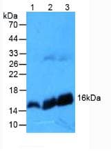 HBB / Hemoglobin Beta Antibody (aa1-147)