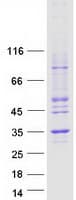 Human NUBP2 Protein (Recombinant Myc-DDK (Flag))