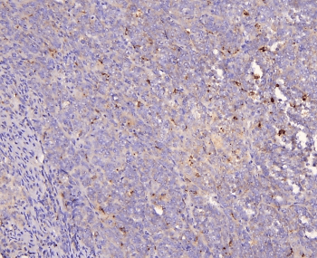 HOOK2 Antibody