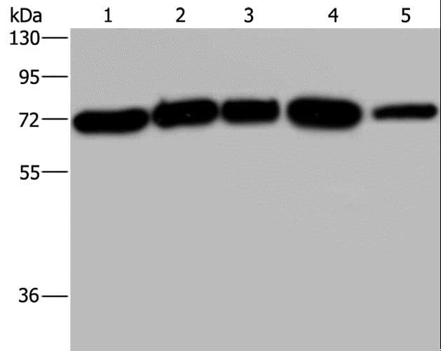Polyclonal Rabbit anti-Human AGFG1 Antibody (IHC, WB)
