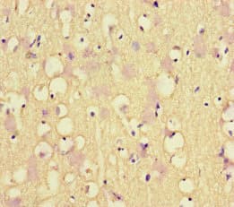 Polyclonal Rabbit anti-Human MLH1 Antibody (IHC, IF, WB)