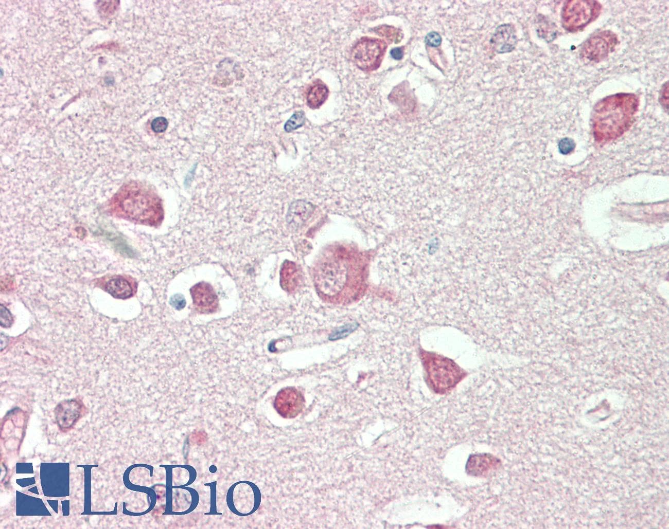 IHC-plus™ PDE2A Antibody (clone 5B10)