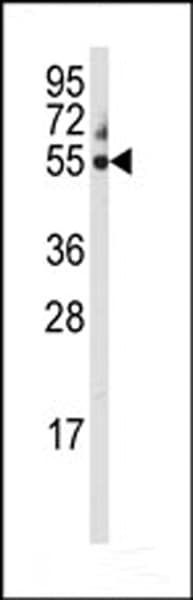 Polyclonal Rabbit anti-Human CYP3A5 Antibody (aa476-502, IHC, IF, WB)
