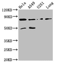 Polyclonal Rabbit anti-Human PCSK2 Antibody (IHC, WB)