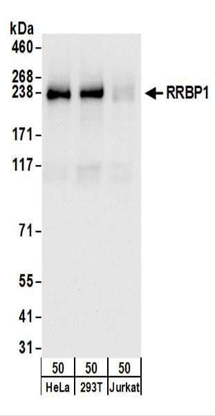 RRBP1 / hES Antibody (aa1425-1472)