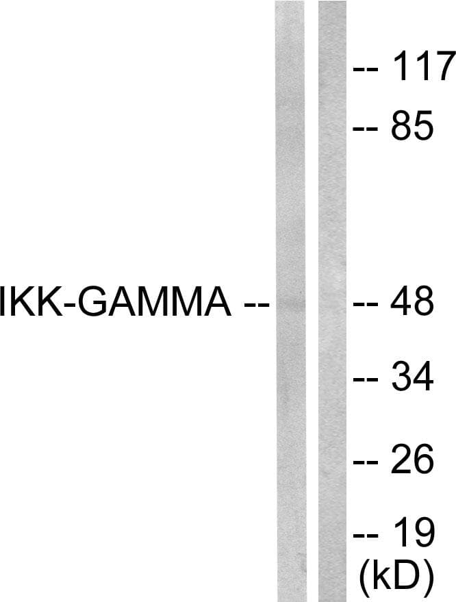 IKBKG / NEMO / IKK Gamma Antibody (p31)