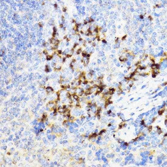 CHI3L1 / YKL-40 Antibody