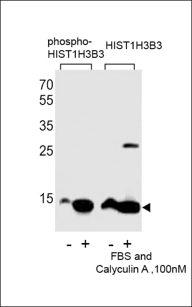 Polyclonal Rabbit anti-Human HIST1H3E Antibody (phospho-Ser10, IHC, WB)