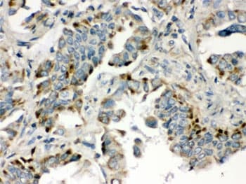 BMP5 Antibody