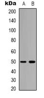 BEST2 / Bestrophin-2 Antibody
