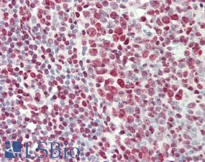 IHC-plus™ Polyclonal Rabbit anti-Human POM121 Antibody (C-Terminus, IHC, WB)