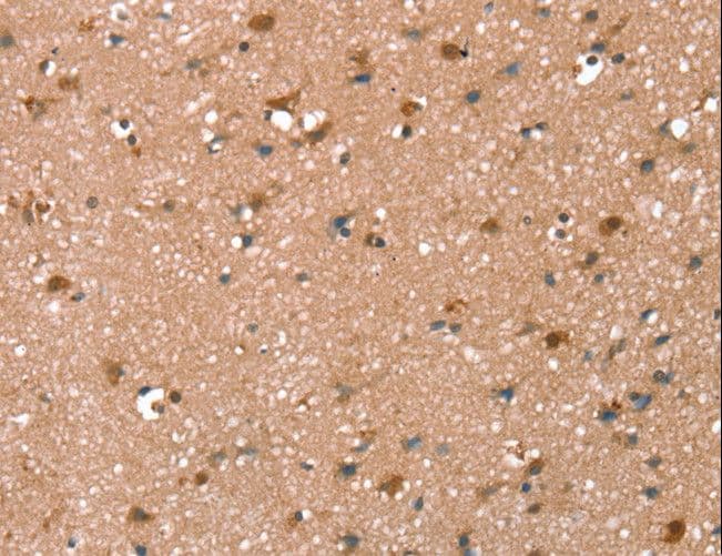 SYNPO2 / Synaptopodin 2 Antibody