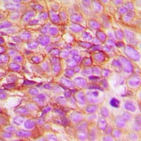 Polyclonal Rabbit anti-Human TSAP6 / STEAP3 Antibody (C-Terminus, IHC, IF, WB)
