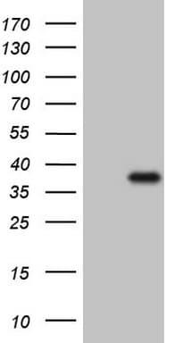 CTDSP2 Antibody (clone OTI10G10)
