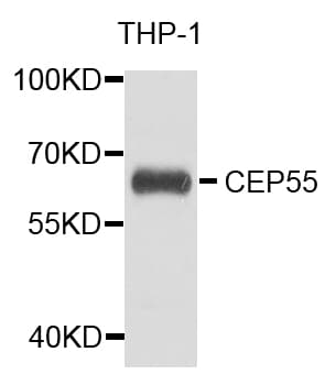 Polyclonal Rabbit anti-Human CEP55 Antibody (WB)
