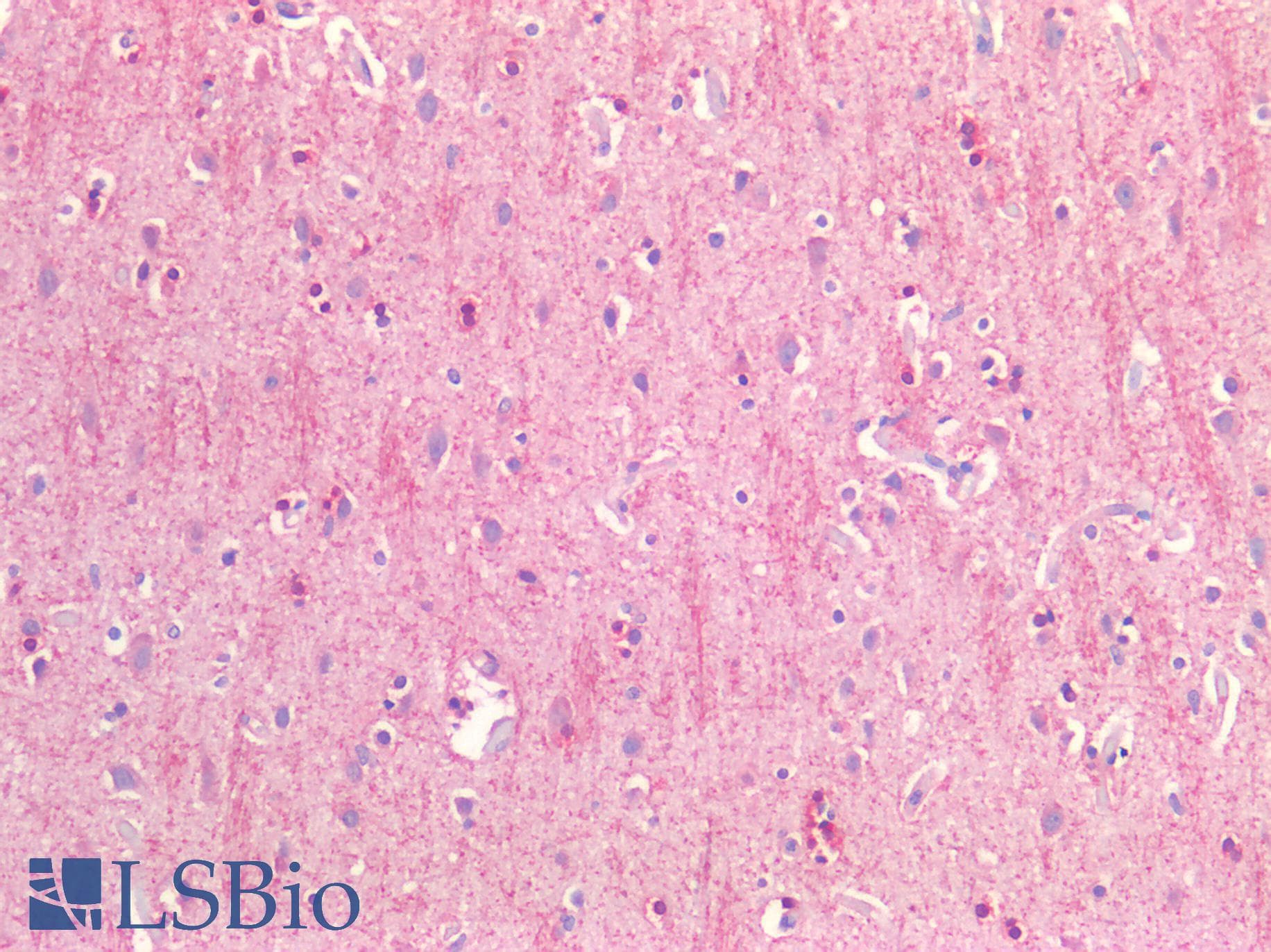 IHC-plus™ CD81 Antibody