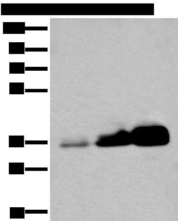 Polyclonal Rabbit anti-Human UBE2Z / USE1 Antibody (IHC, WB)
