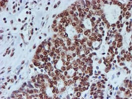 FMR1 / FMRP Antibody (clone OTI3B4)